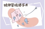 试管移植后胎停育多久会表现出来